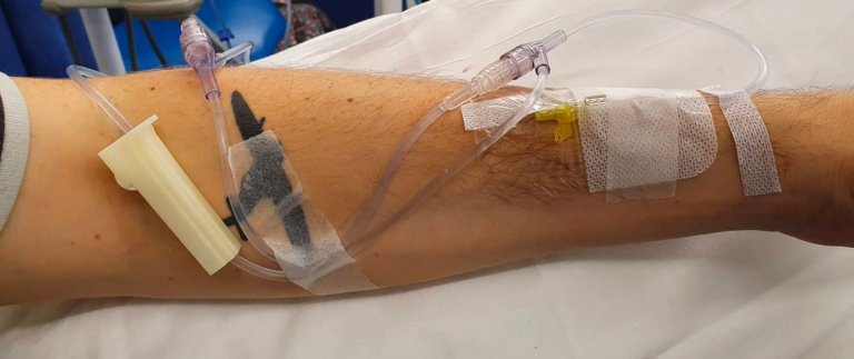 My arm during chemotherapy
