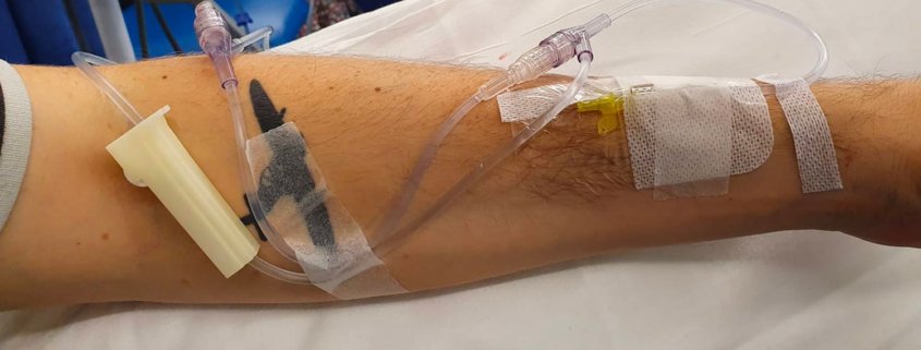 My arm during chemotherapy